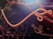 What is Hemorrhagic Fevers: Examples, Causes, Symptoms and Prevention hemorrhagic fevers